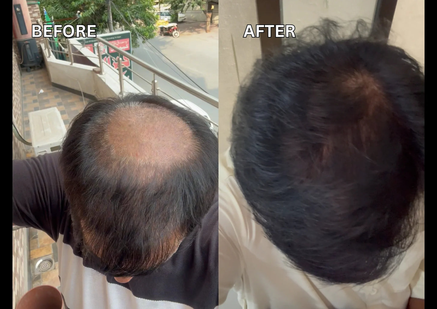 Before and after comparison best hair oil in pakistan