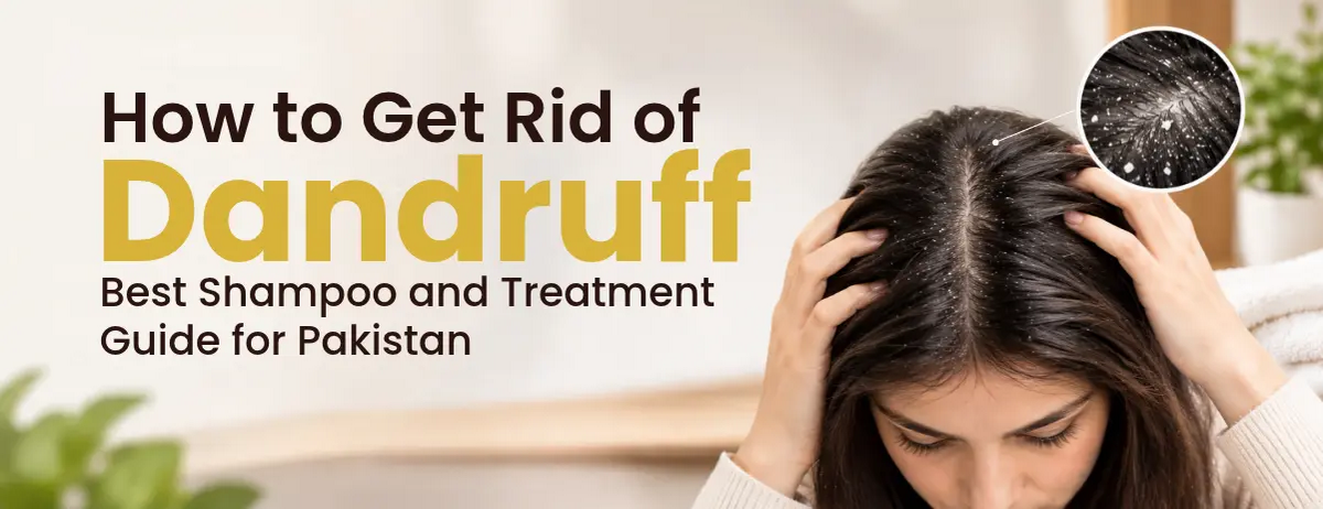 How to Get Rid of Dandruff