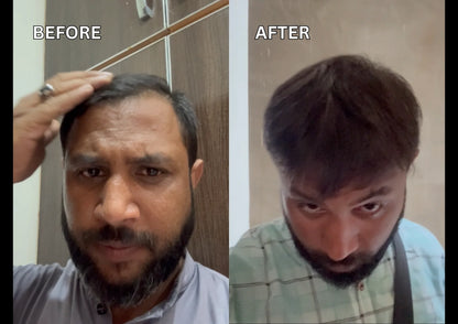 Before and After results best hair oil in pakistan