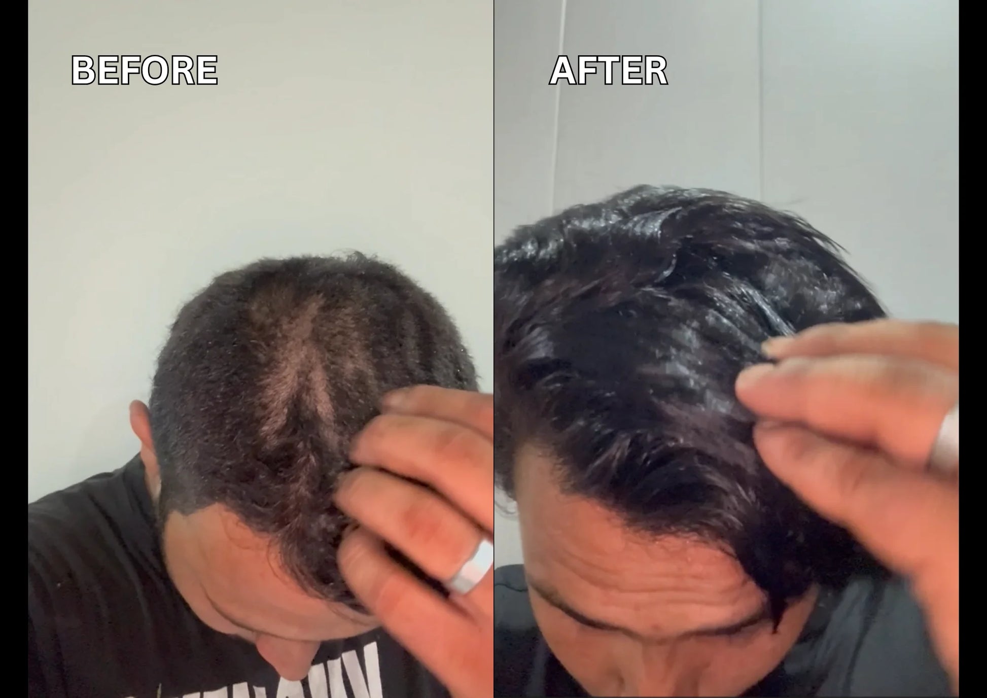 Before and after using best hair oil in pakistan