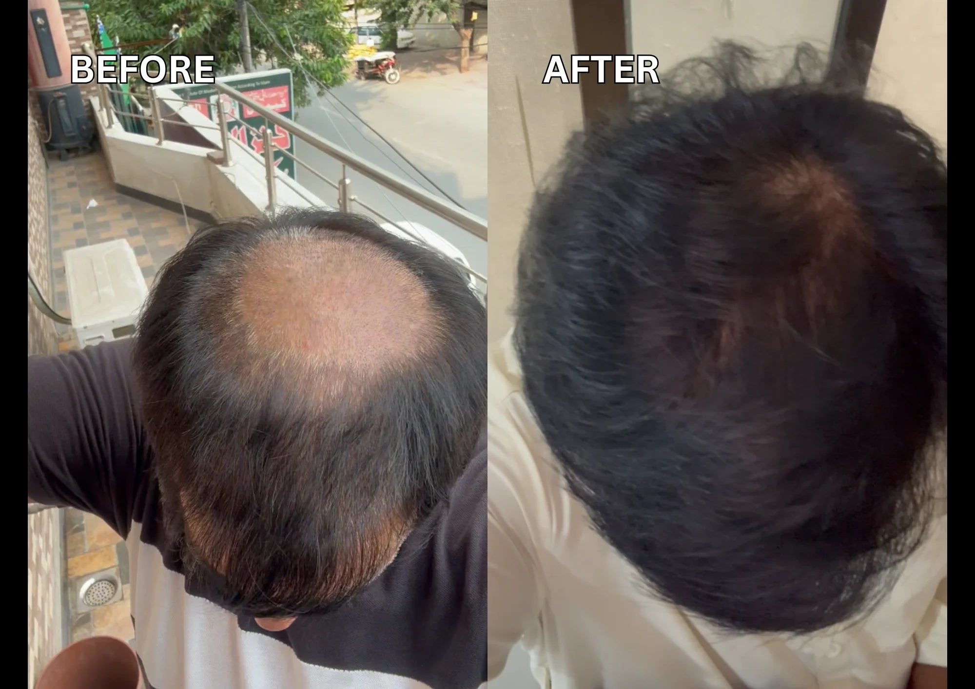 Before and after comparison best hair oil in pakistan